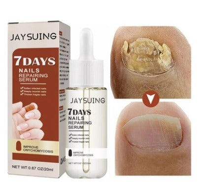 7 DAYS FUNGUS SERUM PARA HONGOS EN UÑAS DE PIES Y MANOS